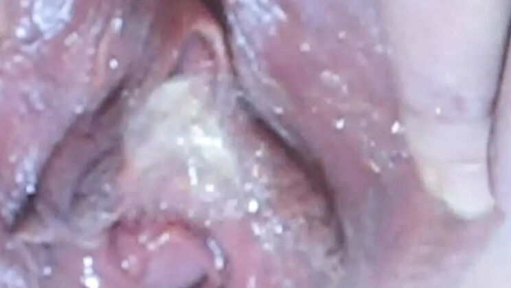 Close Up Pissing Compilation 2 - Deep Keely's Bald Pussy Spread Wide Open
