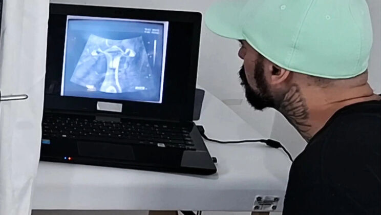 Skinny Redhead Wife Gets Gyno Exam While Cuckold Husband Watches